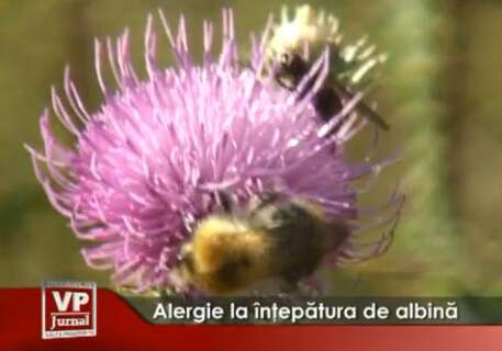 1197-457x320 Alergie la înţepătura de albină